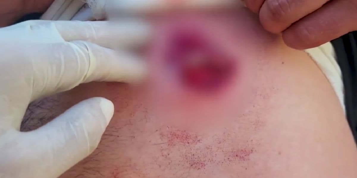 поранена людина