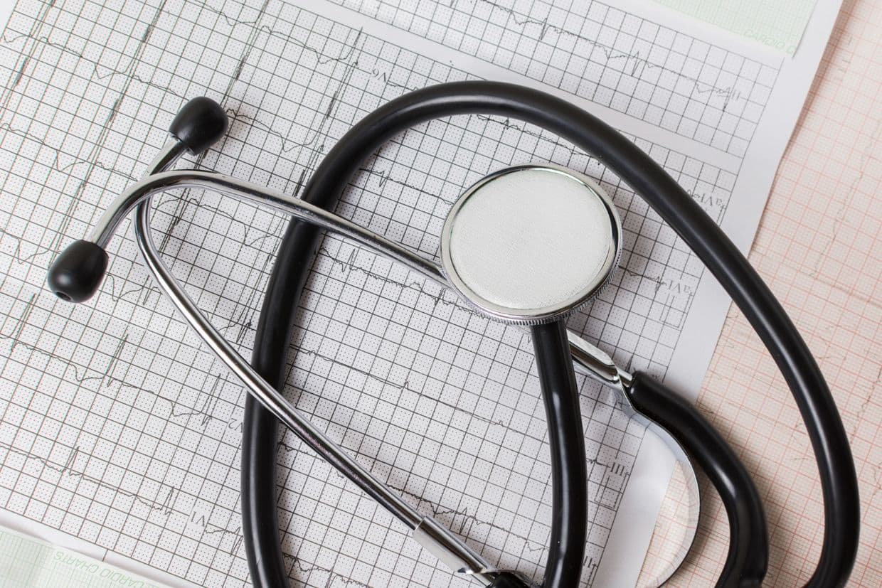 <em>Стетоскоп і кардіограма. Фото: Freepik</em>