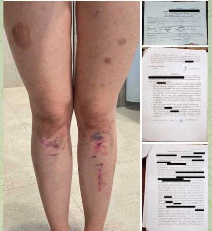 В окупованому Маріуполі мігрант згвалтував 15-річну дівчину