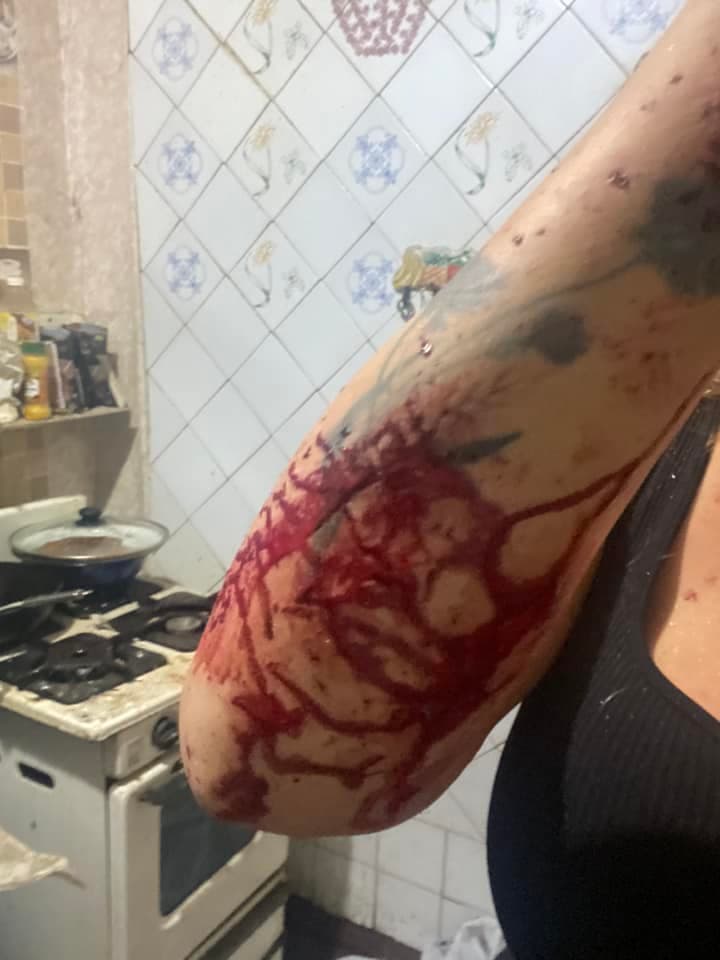 поранена моніка андрушевська 2