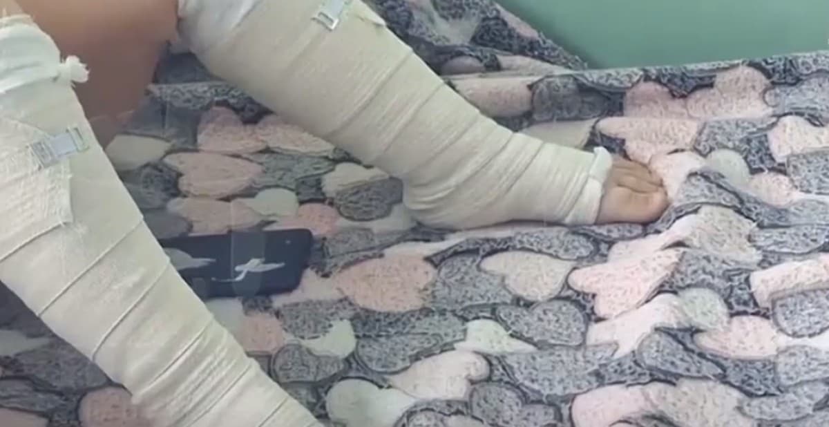 П'ятирічного хлопчика обпалило тосолом у маршрутці в окупованому Донецьку