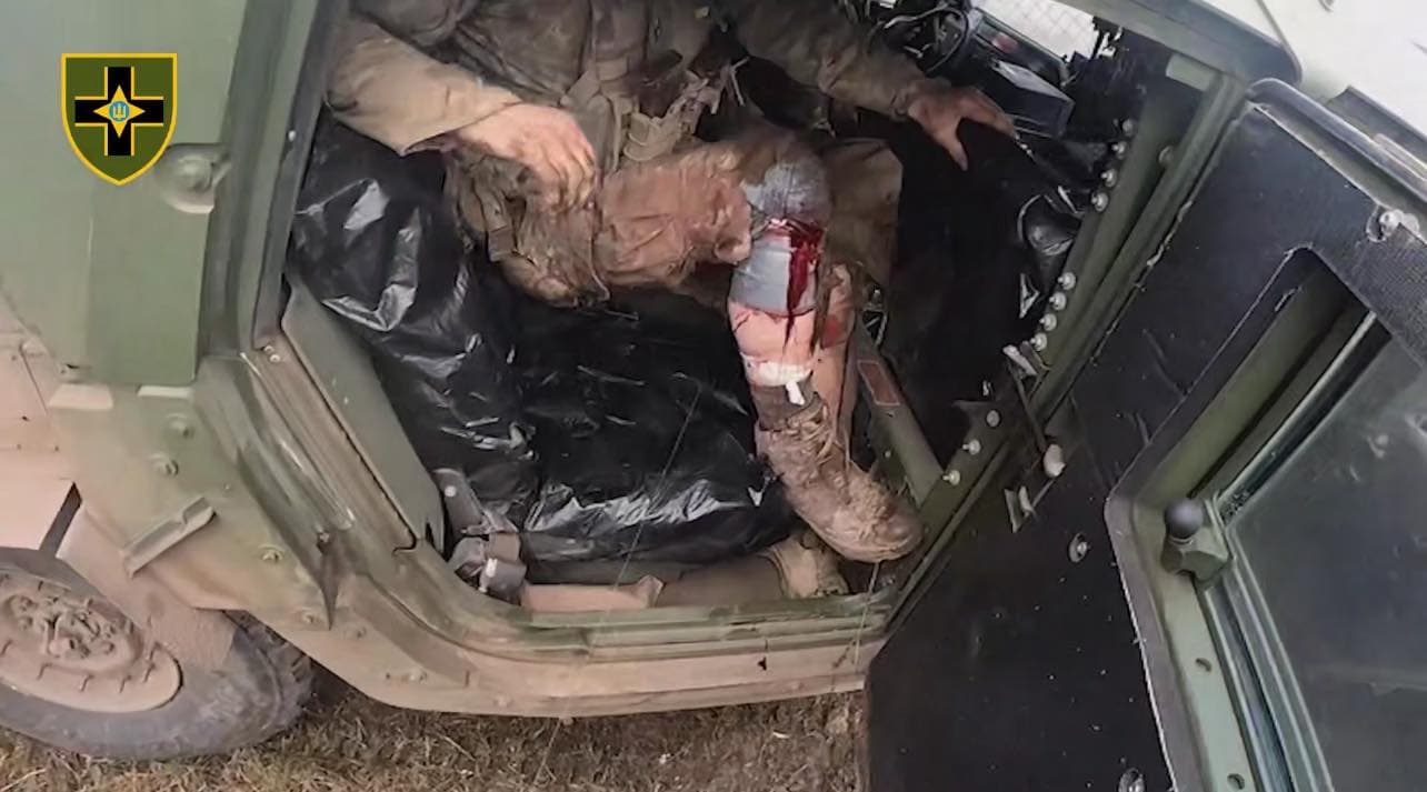 Воїни 28 ОМБр врятували побратимів під щільним обстрілом на Торецькому напрямку