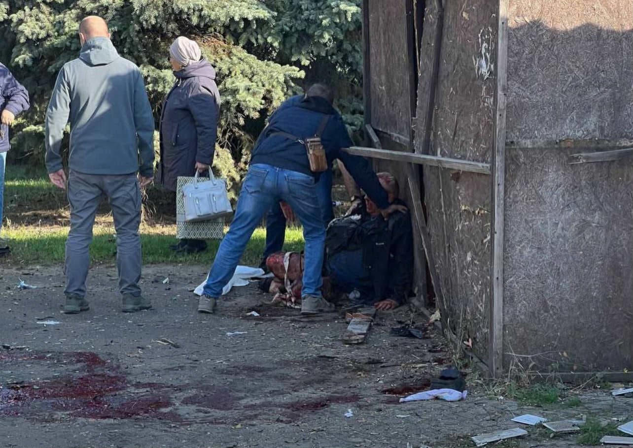 <em>В окупованому Луганську чоловіку відірвало ногу. Фото з Телеграм</em>