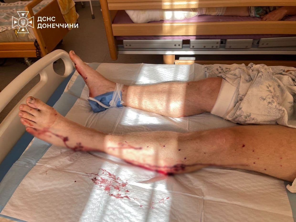ДСНС Донеччини повідомило, що окупанти атакував пожежно-рятувальну частину: четверо рятувальників поранені