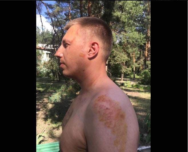 На блокпосту Новоайдарского района полиция избила известного активиста (фото)