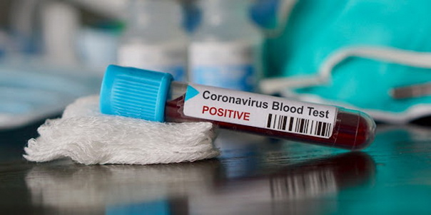 В "ЛНР" заявляют, что 270 человек находится на обсервации на коронавирус
