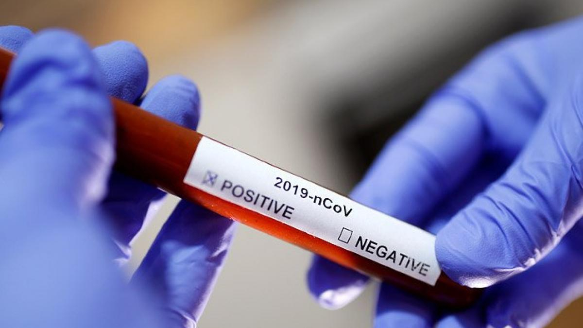 В Украине зафиксировано более тысячи случаев коронавирусной болезни