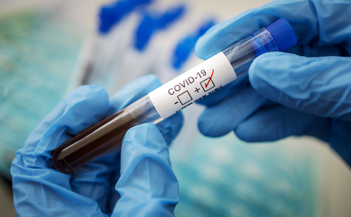 В ОРДО подтвердили еще два случая инфицирования коронавирусом