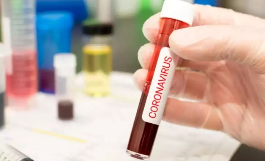 В Украине коронавирусом заразирось 21905 человек, 321 случай выявили за сутки