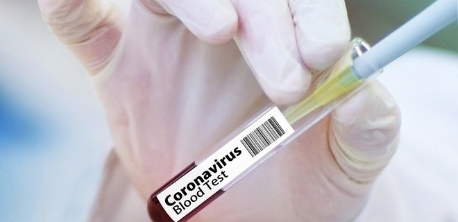 В ОРДО вводят платное тестирование на коронавирус: кого обяжут проходить