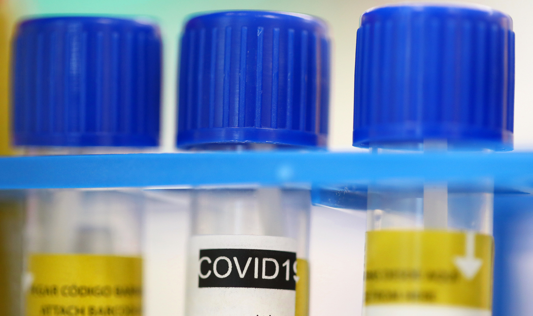 В "ДНР" 22 новых случая заболевания COVID-19, общее число почти достигло 800