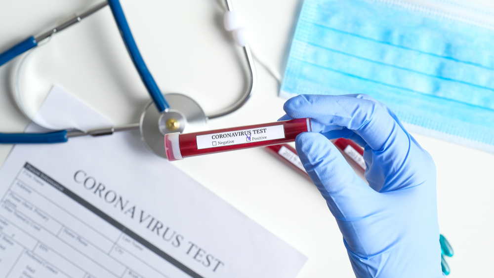 В "ЛНР" признали 471 случай заболевания коронавирусом