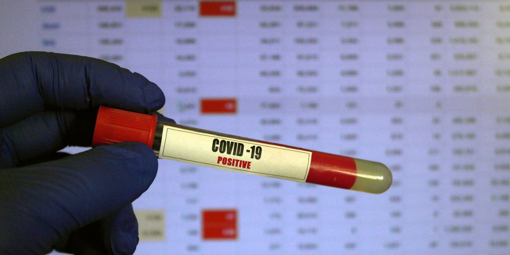 В Украине зафиксировано 889 новых случаев коронавирусной болезни COVID-19