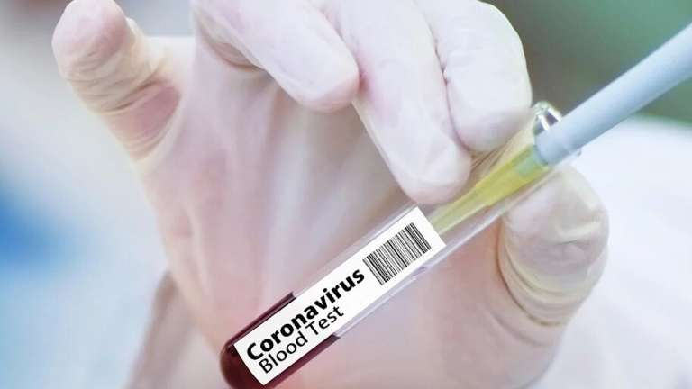 В "ЛНР" заявили о 521 случае заражения коронавирусом