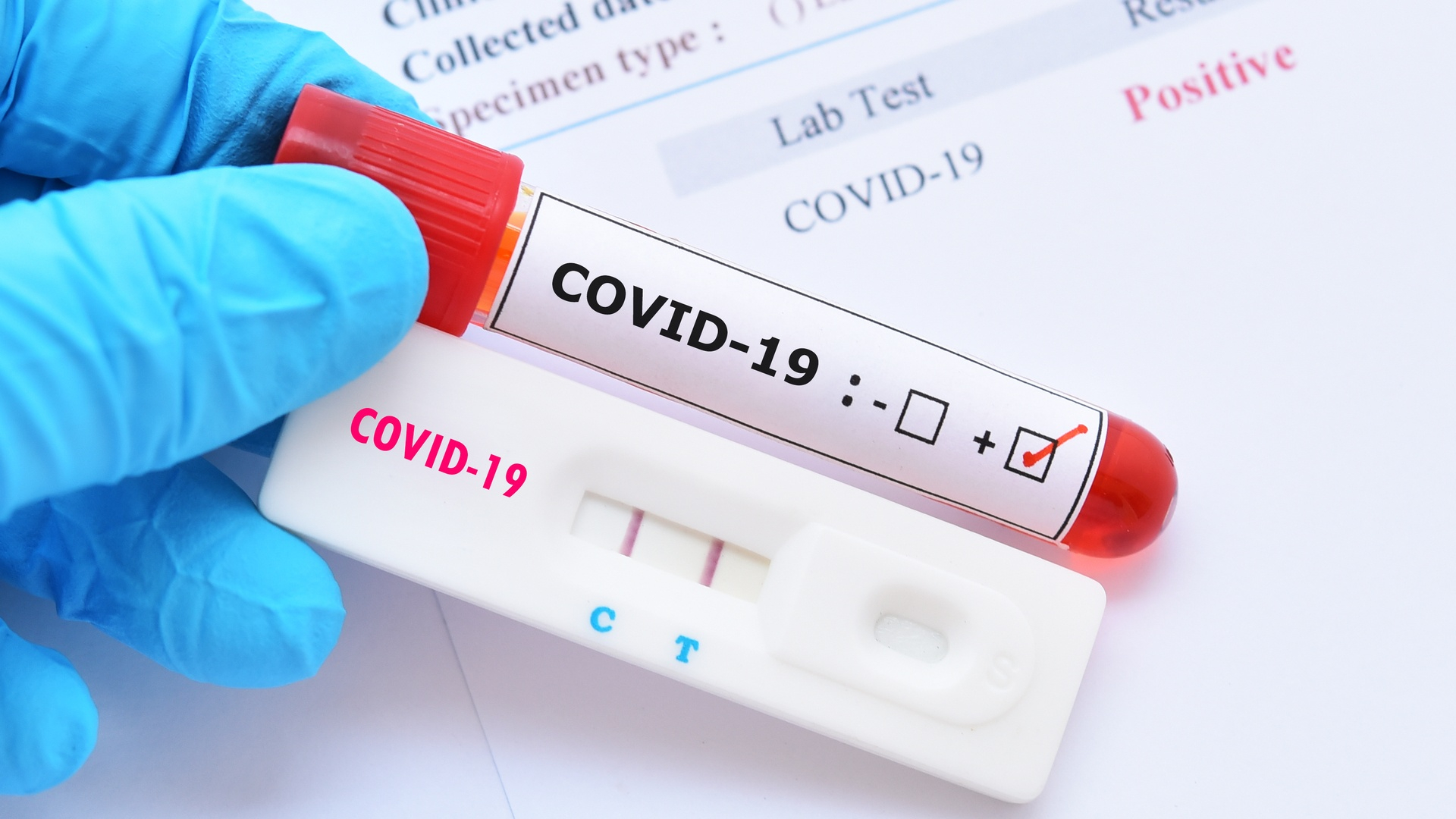 На Донетчине за сутки +27 новых случаев заболевания COVID-19