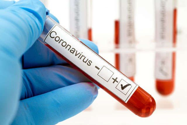 В "ДНР" заявили о 16 новых случаях заболевания коронавирусом