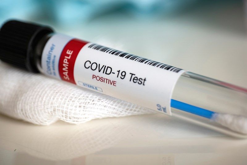 В "ДНР" заявляют о 30 выявленных больных коронавирусом