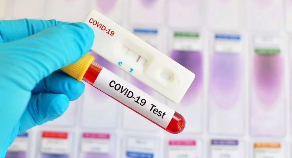 В "ДНР" зафиксировали 37 новых случаев коронавируса, один человек умер