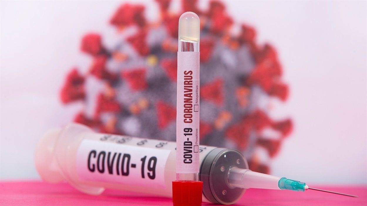 На Луганщине 11 новых случаев заболевания коронавирусом