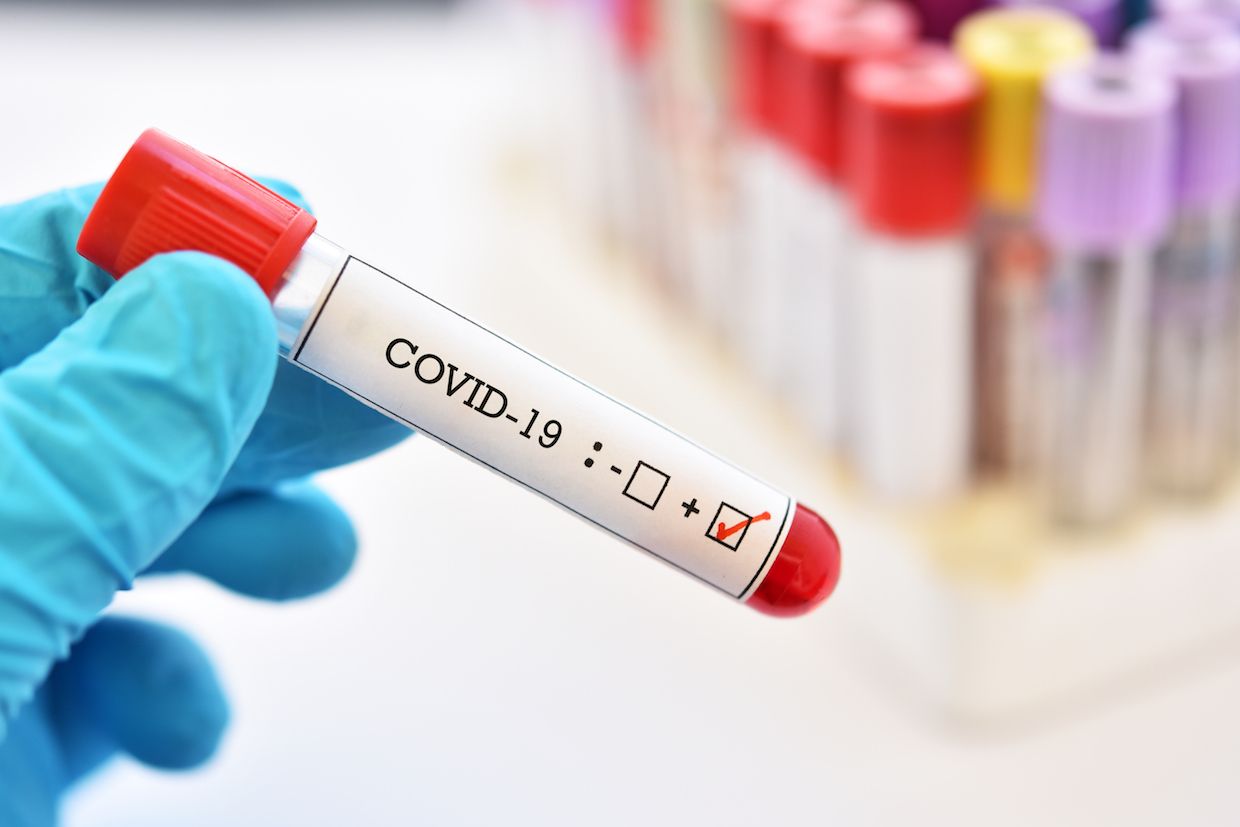 На Донетчине выявили 17 новых больных COVID-19: болезнь диагностировали у 4 детей