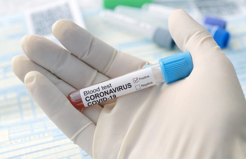 В Украине выявлено более 86 тысяч заболевших коронавирусом