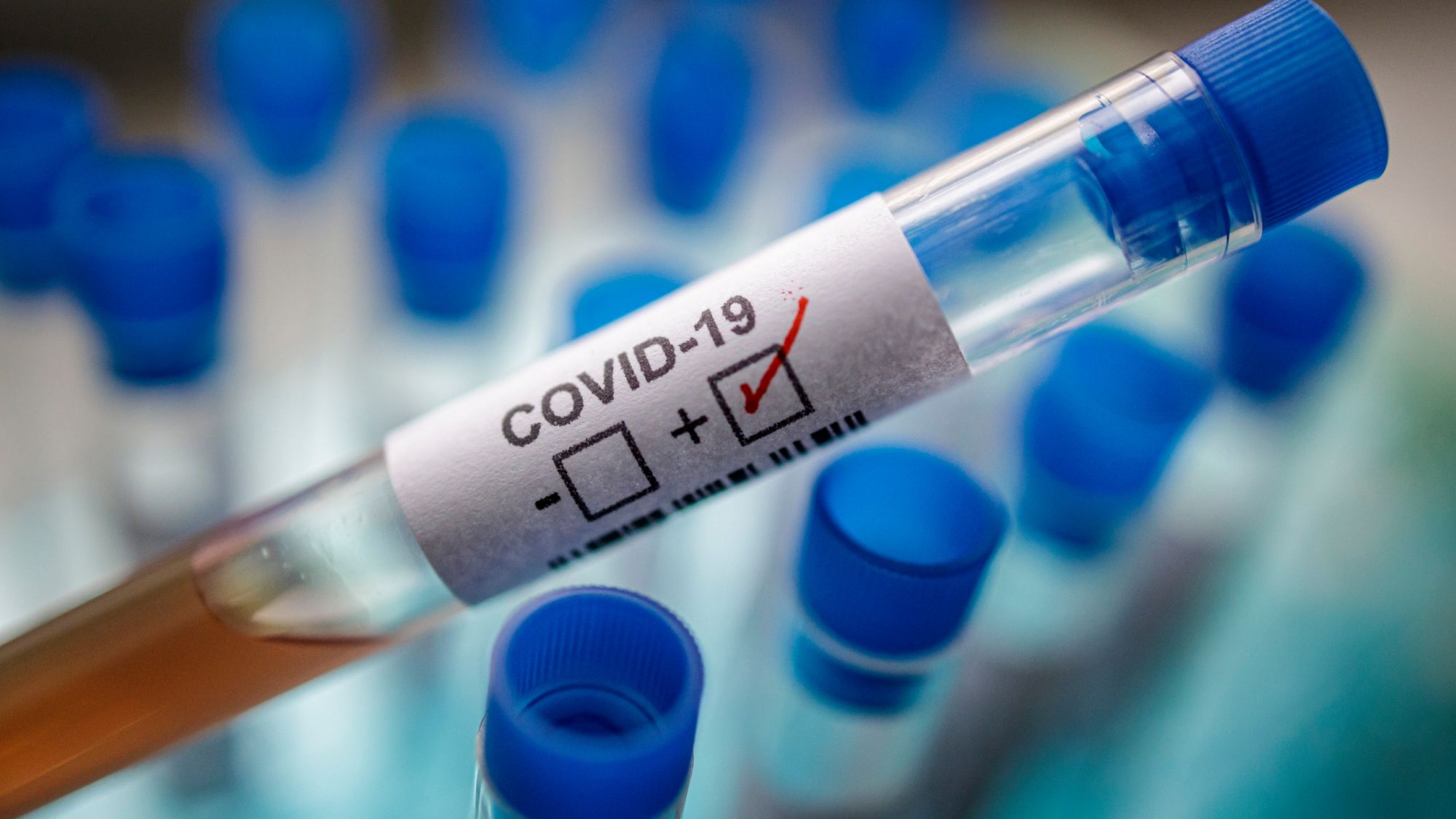 В "ДНР" заявляют 35 новых случаях инфицирования COVID-19