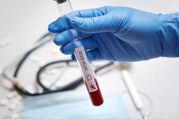 В Луганской области зафиксировали 4 новых случая заболевания коронавирусом