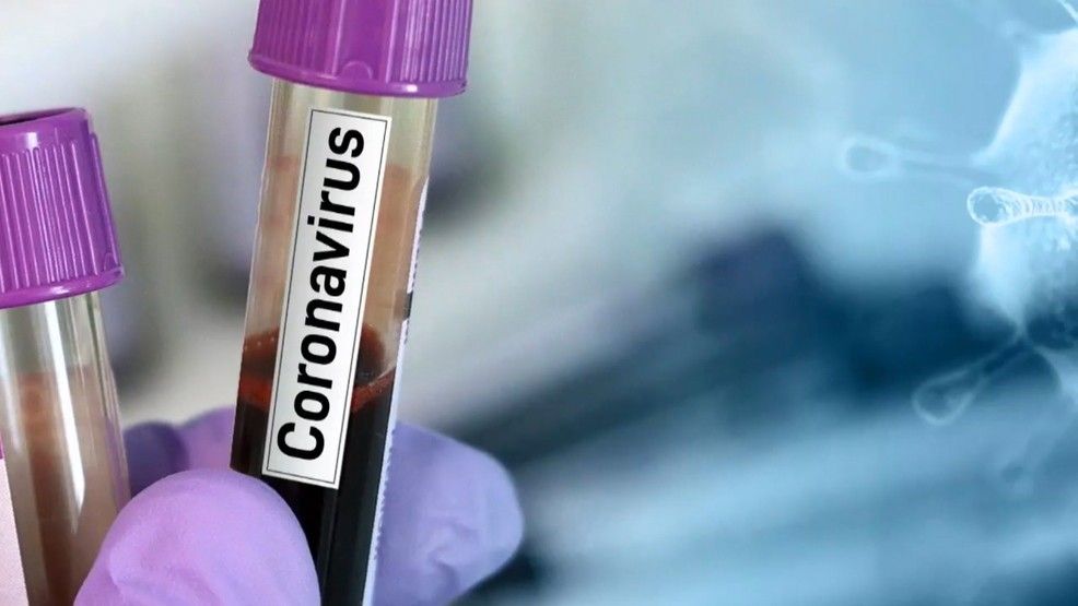 В Украине очередной антирекорд: 1732 выявленных случаев коронавируса за сутки