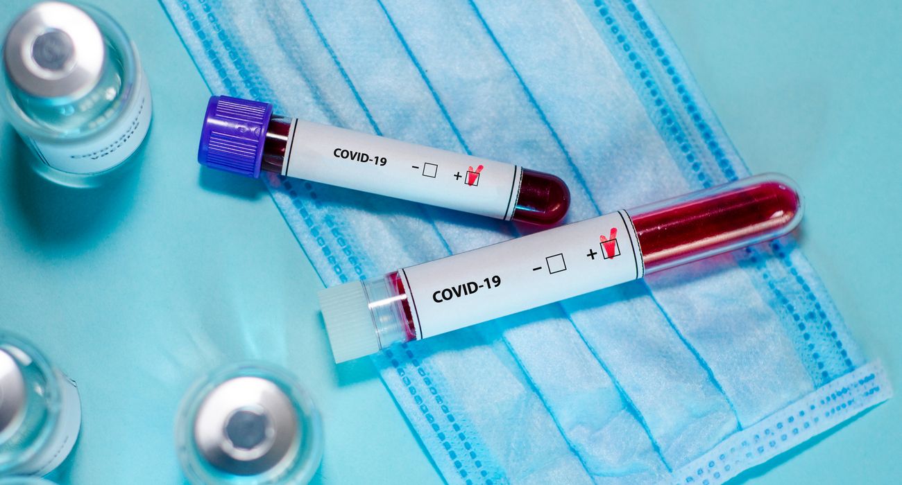 В Украине выявлено 1 637 новых случаев COVID-19, всего 91 356 больных