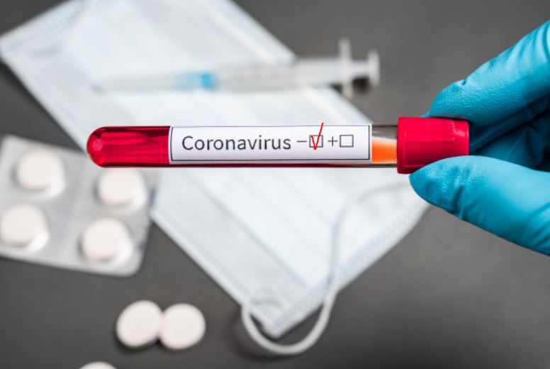 В "ДНР" заявили, что за минувшие сутки выявили 24 новых случая коронавируса