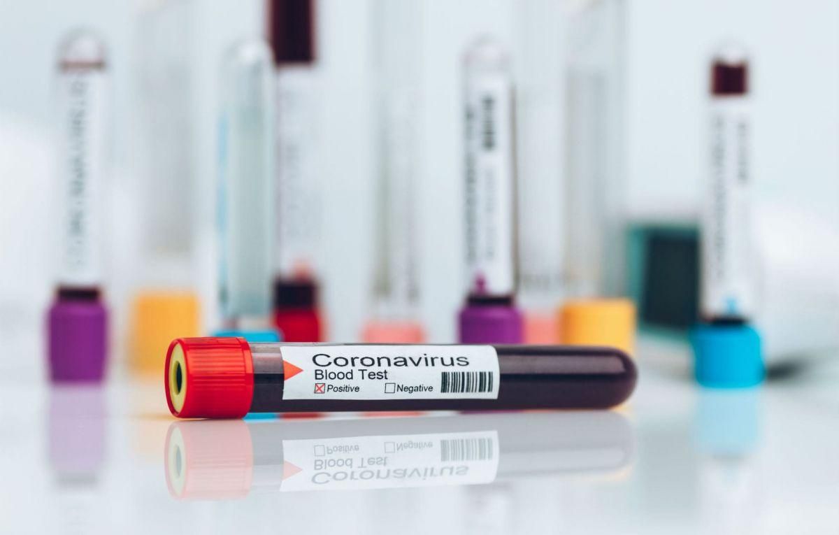 Оккупационные "власти" Горловки подтвердили наличие коронавируса у сотрудника "администрации"