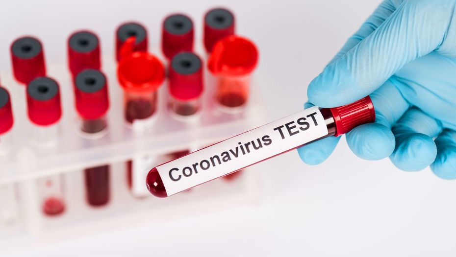 В "ЛНР" подтверждают 638 случаев коронавируса