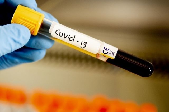 26 августа коронавирус обнаружили еще у 32 жителей Донетчины