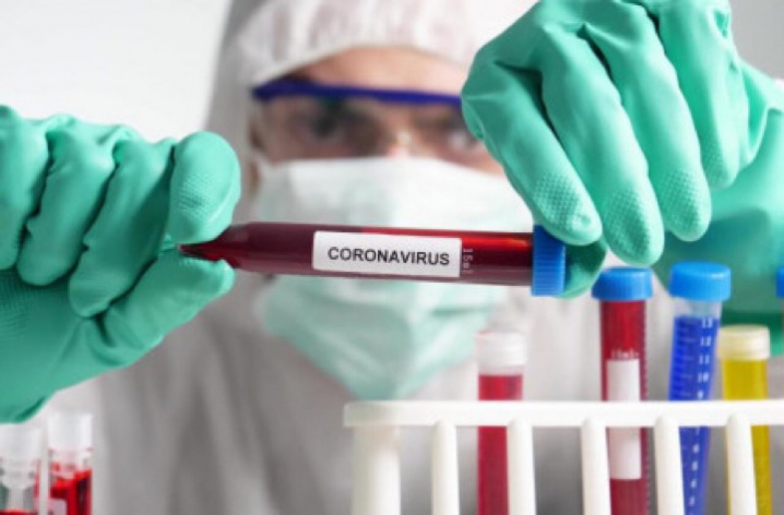 У ОРДО за минулу добу виявили 7 випадків зараження COVID-19: 2 людини померли