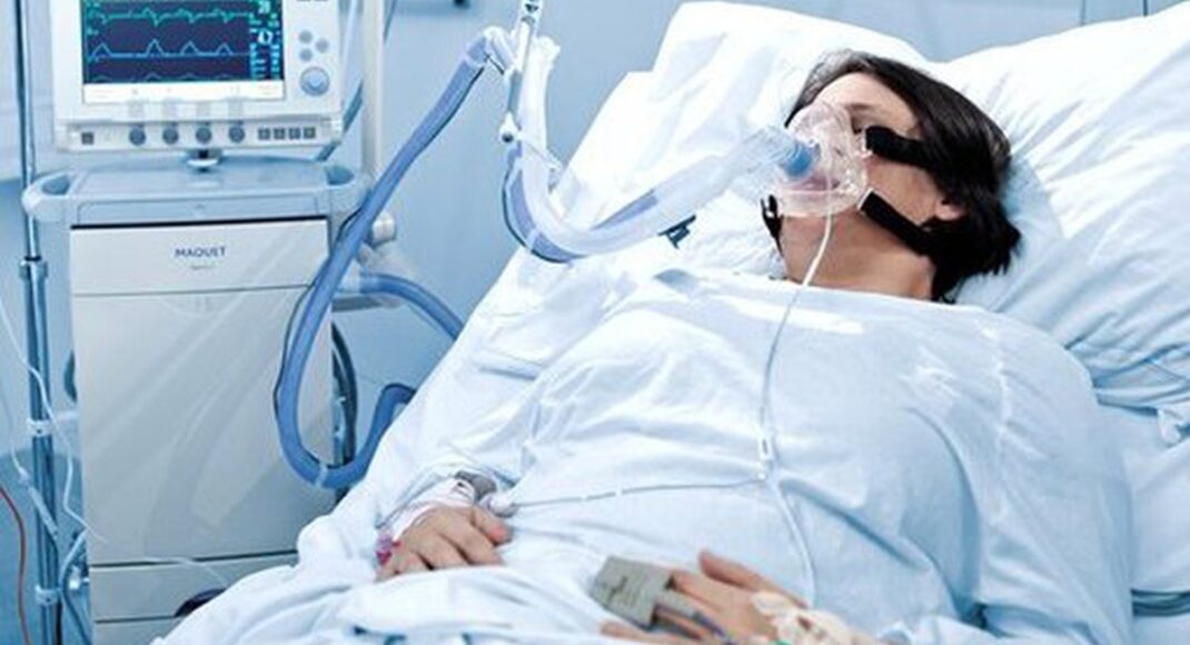 У МОЗ повідомили, скільки апаратів ШВЛ знаходиться в лікарнях Луганщини