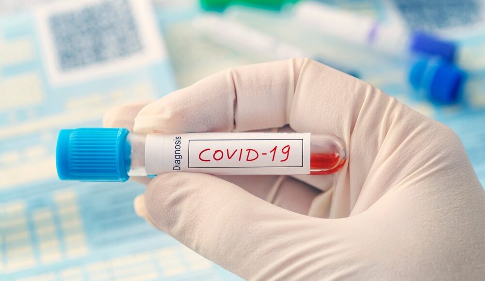 На Луганщині лабораторно підтверджено 119 нових випадків COVID-19 за добу
