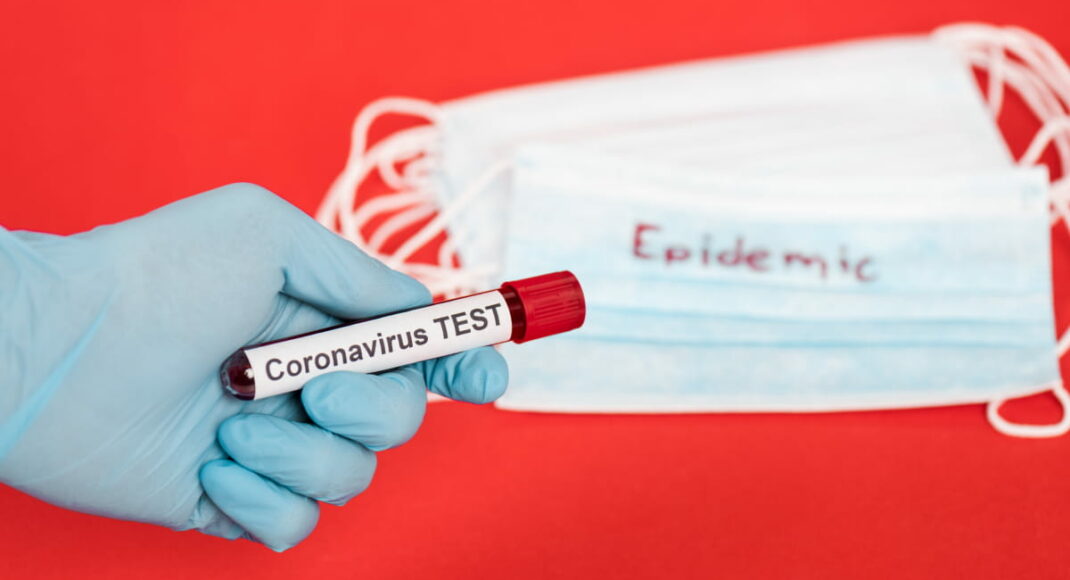 На Донеччині 961 новий випадок коронавірусної хвороби COVID-19, на Луганщині 292, - МОЗ