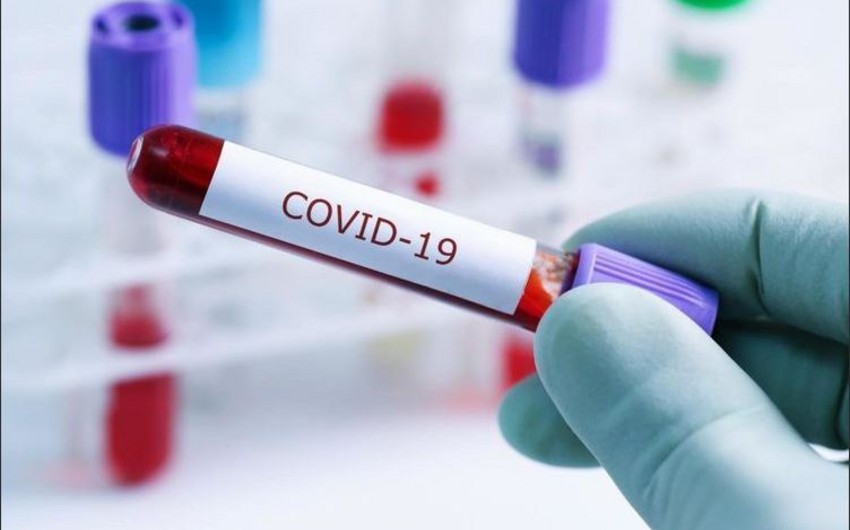 У Донецькій області виявлено 1018 нових випадків COVID-19, у Луганській - 478
