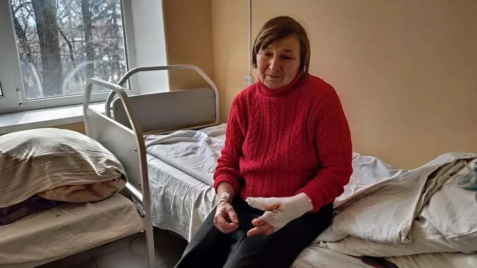 Стало известно о состоянии здоровья жительницы Марьинки, раненной в результате обстрела (фото)