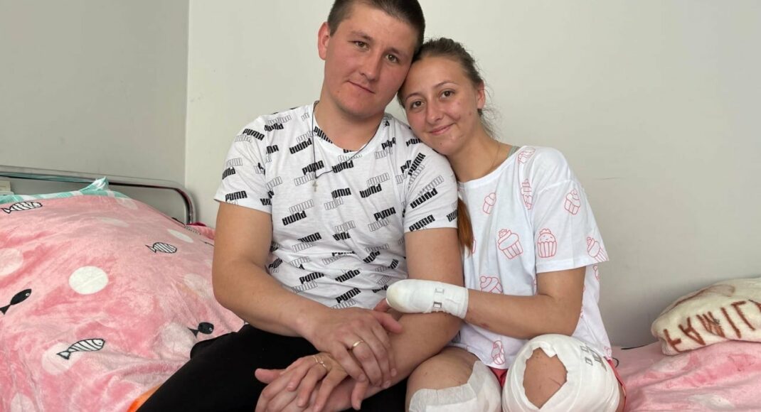 У Львові вийшла заміж медсестра з Лисичанська, яка втратила кінцівки через вибух міни росії