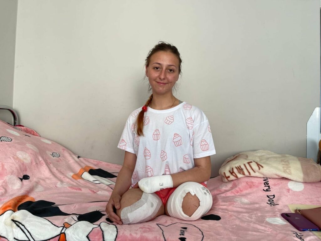 Во Львове вышла замуж медсестра из Лисичанска, потерявшая конечности из-за взрыва мины рф