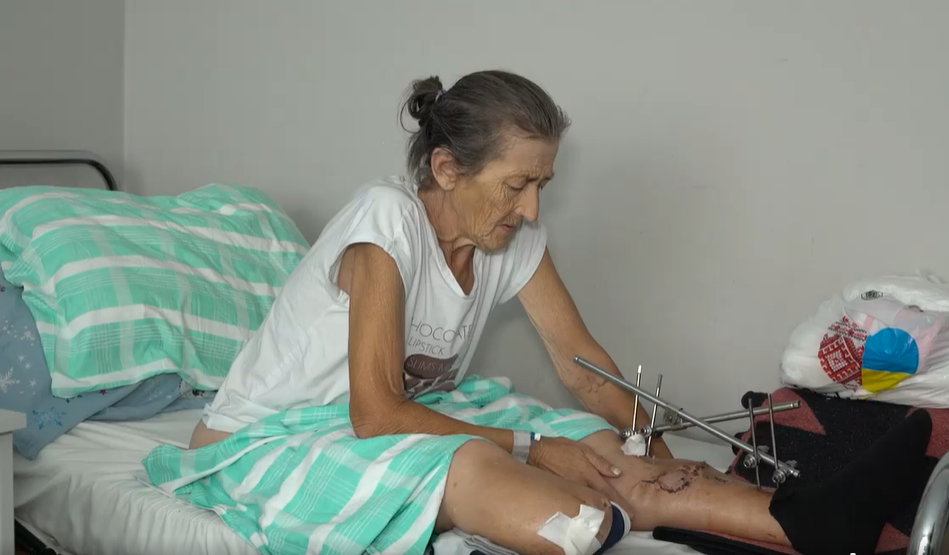 У Львові медики рятують ногу жительки Бахмуту, яка потрапила під обстріли росіян: відео